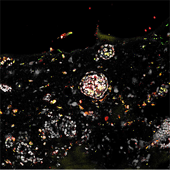 Researchers Achieve Landmark Implantation of Human Embryos into Uterine Organoids, Offering New Hope for IVF Success and Early Pregnancy Research