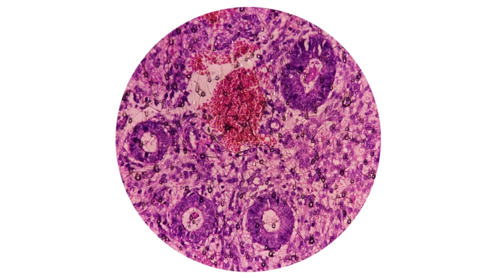 The Download: How America Lost Its Lead in the Hunt for Alien Life, and Ambitious Battery Claims