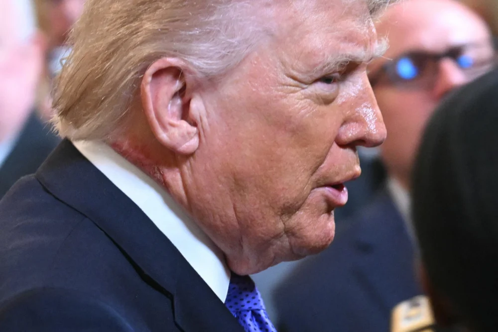 White House Responds as Scabby Mark Appears on Trump’s Neck