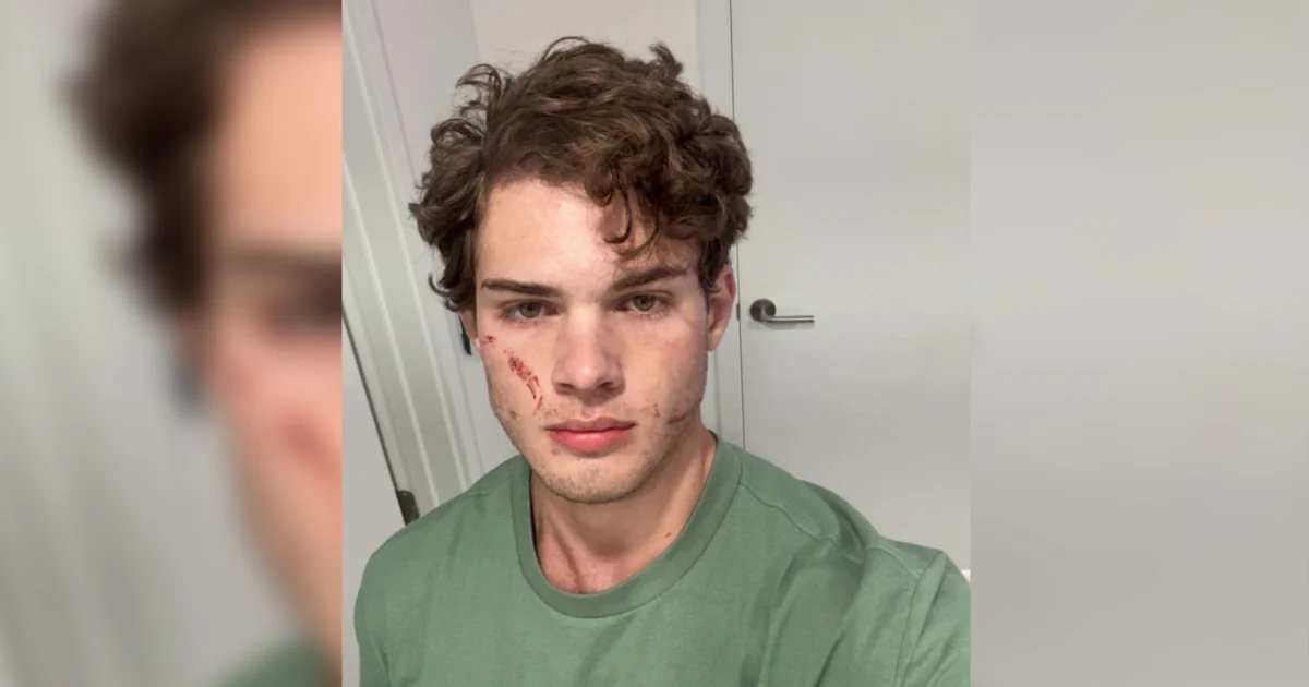 Clavicular Rushed to Hospital in Perfect Illustration of Why Looksmaxxing Is a Horrifying Death Cult